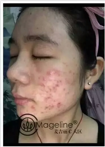 麦吉丽谁用过,效果咋样.jpg