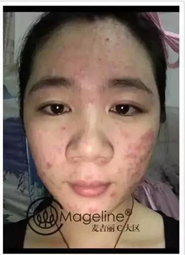 麦吉丽谁用过,效果咋样1.jpg